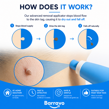 SkinAway | Simple Skin Tag Removal. From Home